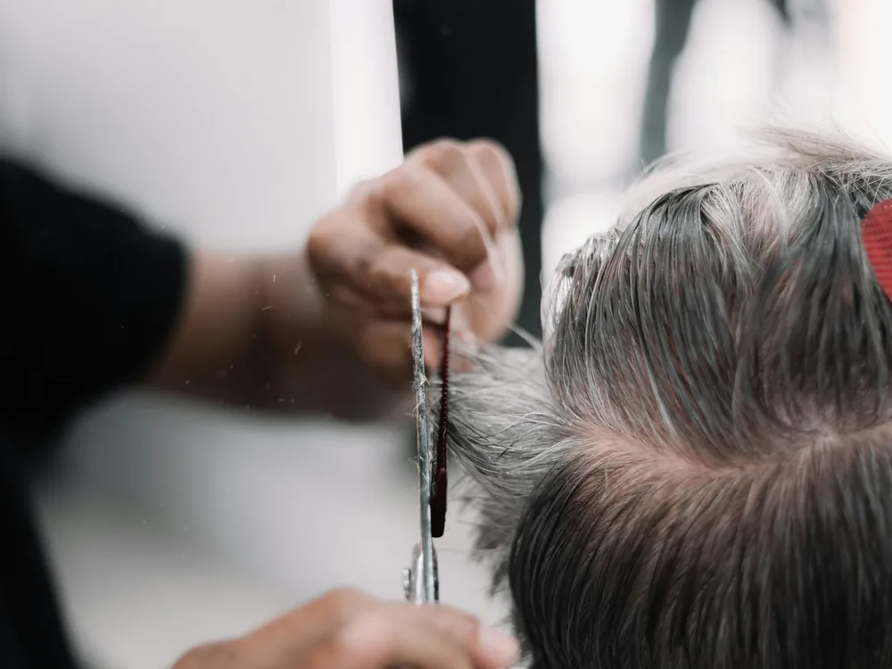 Haar und Haarlinie – Beratung zur Haartransplantation in Mannheim